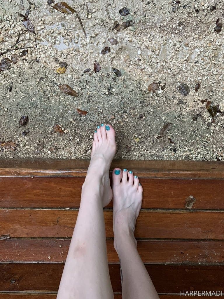 35591772