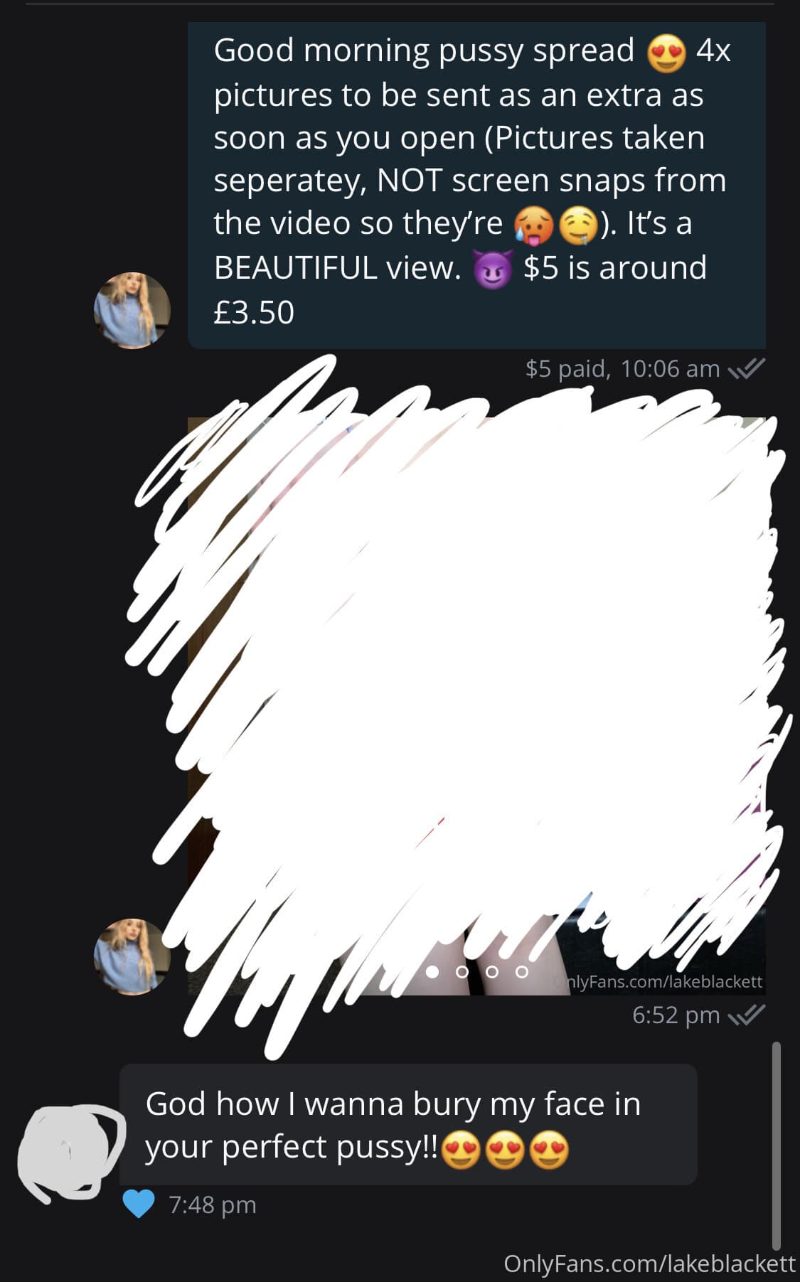 15241793